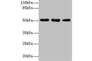 Western blot All lanes: KRT38 antibody at 2 μg/mL Lane 1: MCF-7 whole cell lysate Lane 2: Hela whole cell lysate Lane 3: HepG2 whole cell lysate Secondary Goat polyclonal to rabbit IgG at 1/10000 dilution Predicted band size: 51 kDa Observed band size: 51 kDa (KRT38 anticorps  (AA 2-456))