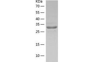 Western Blotting (WB) image for Core 1 Synthase, Glycoprotein-N-Acetylgalactosamine 3-beta-Galactosyltransferase, 1 (C1GALT1) (AA 30-363) protein (His tag) (ABIN7122484)
