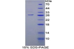 SDS-PAGE (SDS) image for Monoamine Oxidase A (MAOA) (AA 229-428) protein (His tag) (ABIN1099301)