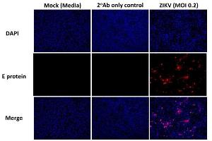 Detection of Zika virus by immunofluorescence using   Immunofluorescence images of Vero cells infected with ZIKV after 30h infection as well as controls. (Recombinant Flavivirus Group Antigen anticorps)