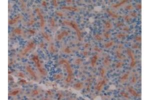 IHC-P analysis of Rat Kidney Tissue, with DAB staining. (Meprin B anticorps  (AA 433-679))