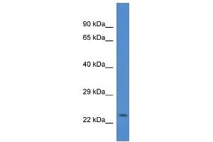 WB Suggested Anti-Csrp2 Antibody   Titration: 1. (CSRP2 anticorps  (Middle Region))