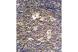 IL4 Antibody (C-term) (ABIN651434 and ABIN2840238) IHC analysis in formalin fixed and paraffin embedded tonsil followed by peroxidase conjugation of the secondary antibody and DAB staining. (IL-4 anticorps  (C-Term))