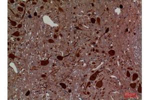 Immunohistochemistry (IHC) analysis of paraffin-embedded Rat Brain, antibody was diluted at 1:100. (Hexosaminidase A anticorps  (Internal Region))
