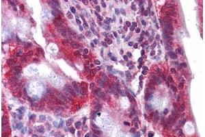 Human Small Intestine: Formalin-Fixed, Paraffin-Embedded (FFPE)