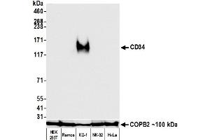 Western Blotting (WB) image for anti-CD34 (CD34) (AA 33-290) antibody (ABIN7453960) (Recombinant CD34 anticorps  (AA 33-290))