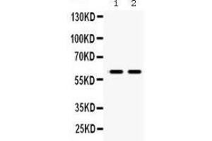 Anti- MAOB Picoband antibody, Western blottingAll lanes: Anti MAOB  at 0.