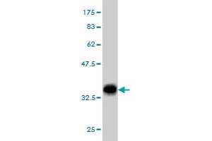 Western Blot detection against Immunogen (32. (EHD2 anticorps  (AA 365-427))