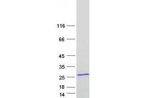 Validation with Western Blot