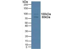 Detection of MAP4 in Human Hela Cells using Polyclonal Antibody to Microtubule Associated Protein 4 (MAP4)