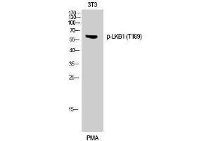 Western Blotting (WB) image for anti-serine/threonine Kinase 11 (STK11) (pThr189) antibody (ABIN3182225) (LKB1 anticorps  (pThr189))