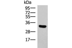 Western blot analysis of Hela cell lysate using KCTD7 Polyclonal Antibody at dilution of 1:1200 (KCTD7 anticorps)