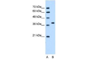 Western Blot showing RUNDC2A antibody used at a concentration of 5. (SNX29 anticorps  (N-Term))