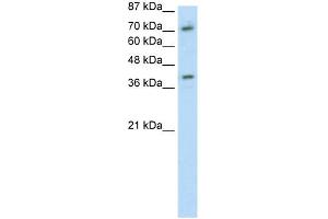 WB Suggested Anti-ZNF282 Antibody Titration: 1. (ZNF282 anticorps  (C-Term))