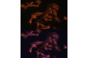 Immunofluorescence analysis of C6 cells using MEK3 antibody (ABIN6130544, ABIN6143484, ABIN6143485 and ABIN6223650) at dilution of 1:100.