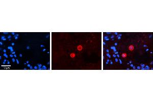 Rabbit Anti-CES2 Antibody     Formalin Fixed Paraffin Embedded Tissue: Human Pineal Tissue  Observed Staining: Cytoplasmic in pinealocytes  Primary Antibody Concentration: 1:100  Other Working Concentrations: 1/600  Secondary Antibody: Donkey anti-Rabbit-Cy3  Secondary Antibody Concentration: 1:200  Magnification: 20X  Exposure Time: 0. (CES2 anticorps  (C-Term))
