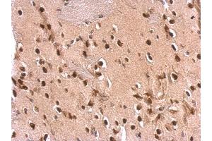 IHC-P Image ETS2 antibody detects ETS2 protein at nucleus on rat fore brain by immunohistochemical analysis. (ETS2 anticorps  (Center))