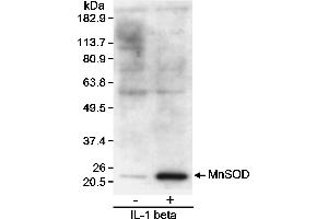Western Blotting (WB) image for anti-Superoxide Dismutase 2, Mitochondrial (SOD2) (C-Term) antibody (ABIN7449178)