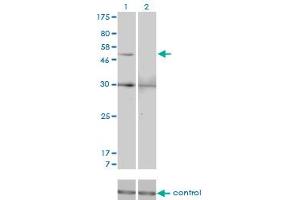 Western blot analysis of MMP13 over-expressed 293 cell line, cotransfected with MMP13 Validated Chimera RNAi (Lane 2) or non-transfected control (Lane 1). (MMP13 anticorps  (AA 362-471))