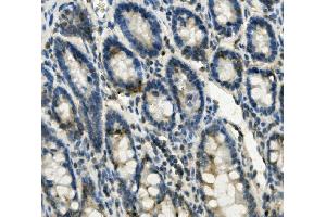 IHC analysis of FABP6 using anti-FABP6 antibody (ABIN7598974).