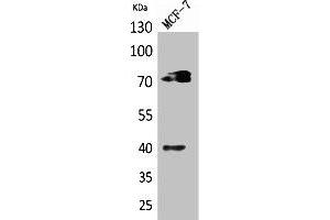 Western Blot analysis of MCF7 cells using CD110 Polyclonal Antibody. (MPL anticorps  (Internal Region))