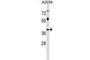 Western Blotting (WB) image for anti-Trophoblast Glycoprotein (TPBG) antibody (ABIN2999221) (TPBG anticorps)