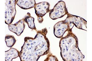 Anti- HSD11B2 antibody, IHC(P) IHC(P): Human Placenta Tissue