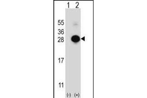 Western blot analysis of MOBKL1B (arrow) using rabbit polyclonal MOBKL1B Antibody (C-term) (ABIN391568 and ABIN2841505). (MOB1A anticorps  (C-Term))