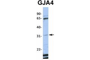 Host:  Rabbit  Target Name:  GJA4  Sample Type:  Jurkat  Antibody Dilution:  1.