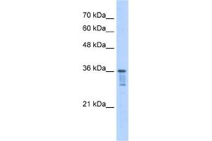 WB Suggested Anti-LZTFL1 Antibody Titration:  2.