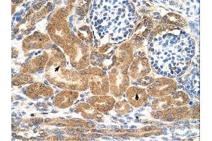 Immunohistochemistry (IHC) image for anti-Transmembrane Protein 69 (TMEM69) (Middle Region) antibody (ABIN2782891) (TMEM69 anticorps  (Middle Region))