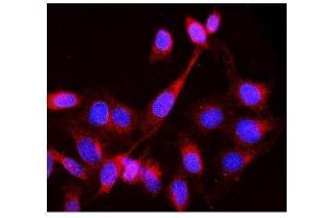 IF analysis of Lck using anti-Lck antibody (ABIN3043870).