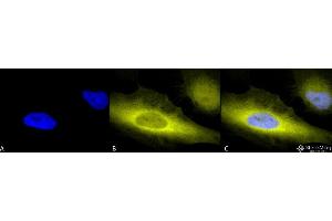 Immunocytochemistry/Immunofluorescence analysis using Rabbit Anti-Ubiquitin Polyclonal Antibody .