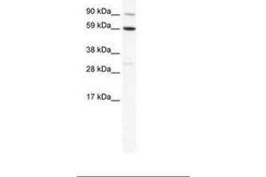 Image no. 1 for anti-T-Bet (AA 455-504) antibody (ABIN202721) (T-Bet anticorps  (AA 455-504))