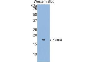 Western blot analysis of the recombinant protein. (SEMA4D/CD100 anticorps  (AA 502-636))