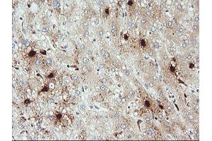Image no. 2 for anti-Kallikrein 8 (KLK8) antibody (ABIN1498966)