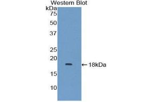Western Blotting (WB) image for anti-Mitogen-Activated Protein Kinase Kinase 1 Interacting Protein 1 (MAPKSP1) (AA 1-124) antibody (ABIN3206653) (MAPKSP1 anticorps  (AA 1-124))