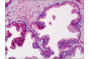 Human Prostate: Formalin-Fixed, Paraffin-Embedded (FFPE). (MMP3 anticorps)