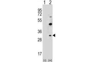 Western Blotting (WB) image for anti-Claudin 2 (CLDN2) antibody (ABIN2996860) (Claudin 2 anticorps)
