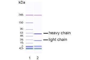 CGE analysis of purified DY-7G2 monoclonal antibody.