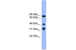 WB Suggested Anti-LAX1 Antibody Titration: 0. (LAX1 anticorps  (C-Term))