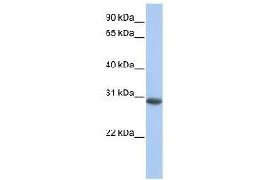 MLF1 antibody used at 1 ug/ml to detect target protein. (MLF1 anticorps  (N-Term))