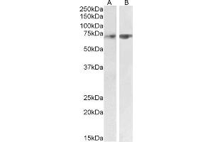 ABIN1590085 (2 μg/mL) staining of Human Cerebellum (A) and Rat Lung (B) lysate (35 μg protein in RIPA buffer).
