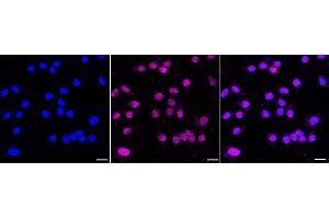 Immunocytochemical staining of HeLa cells with Major vault protein antibody (ABIN7799325), 1:1,000).
