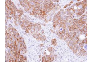 IHC-P Image Immunohistochemical analysis of paraffin-embedded SW480 xenograft, using DARS, antibody at 1:500 dilution.