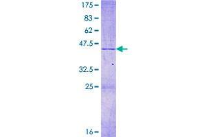 Image no. 1 for Mitochondrial Ribosomal Protein L14 (MRPL14) (AA 1-145) protein (GST tag) (ABIN1311293)