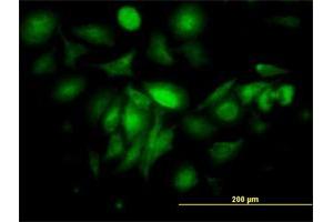 Immunofluorescence of monoclonal antibody to FTL on HeLa cell.