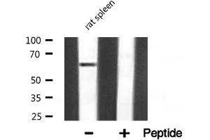 Western blot analysis of NF-kappaB p65 expression in Rat spleen lysate (NF-kB p65 anticorps)