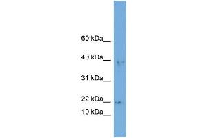 WB Suggested Anti-ARPC3  Antibody Titration: 0. (ARPC3 anticorps  (Middle Region))