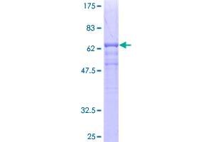Image no. 1 for Transcobalamin II (TCN2) (AA 1-400) protein (GST tag) (ABIN1322403)